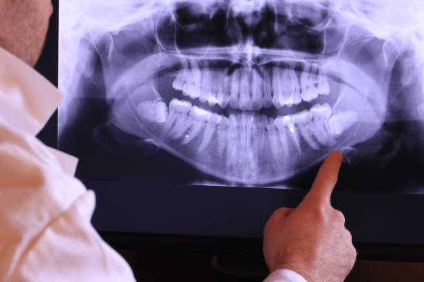 Best Emergency Dental Services for Seniors in Nuevo, CA