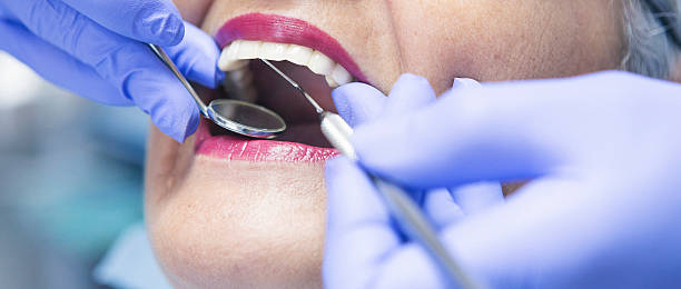 Best Emergency Dentist for Lost Fillings or Crowns in Nuevo, CA